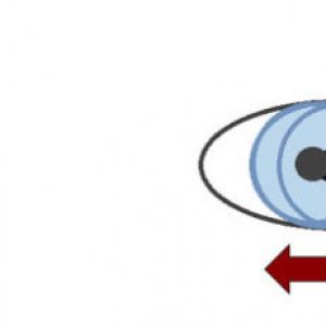 Нистагм глаза у взрослых и детей Всего различают по характеру движения три вида нистагма