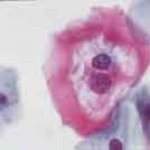 Расшифровка лейкоциты, флора
